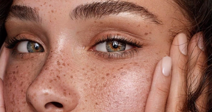 Cara Aman Menguji Sensitivitas Kulit